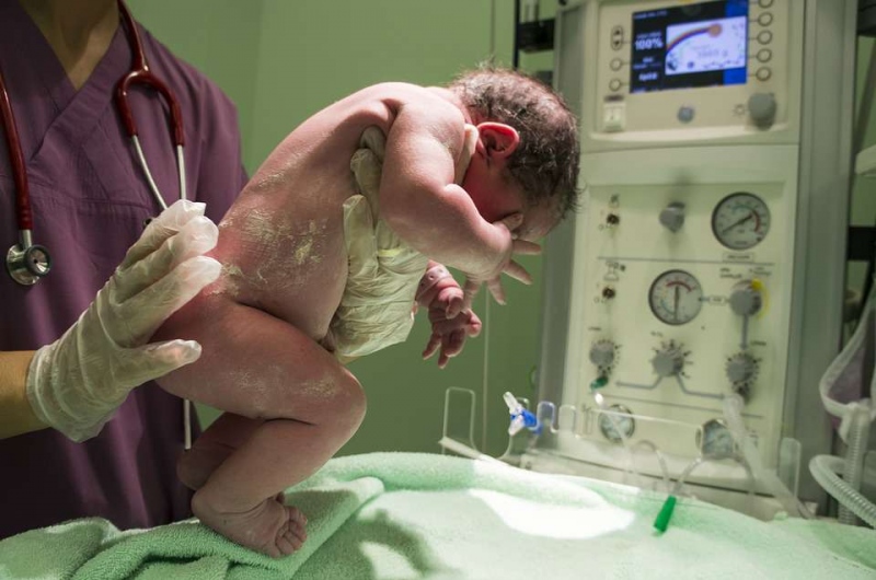 新生儿的心率是多少新生儿测心率的目的